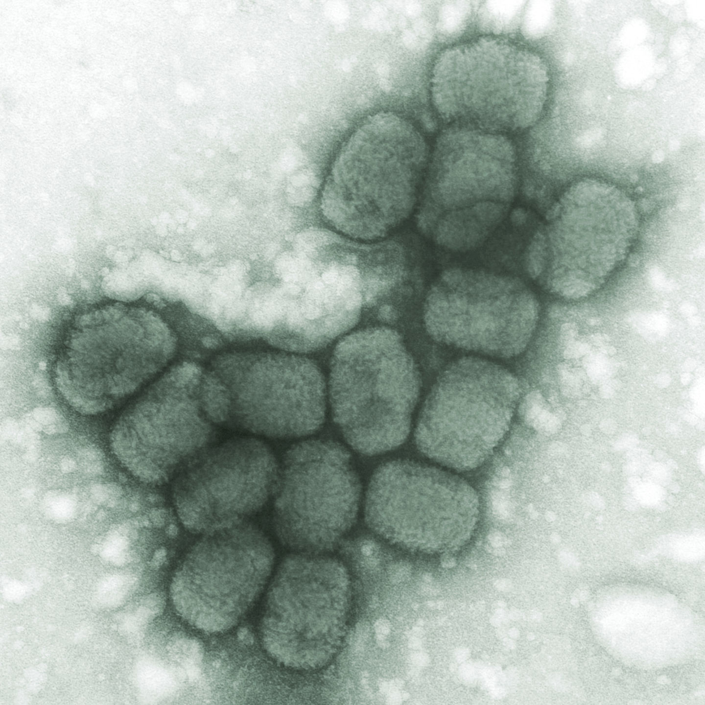 1796: Smallpox